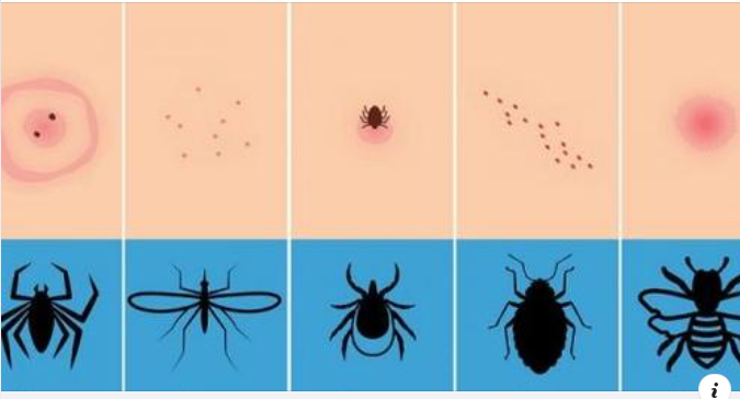 Dokáže rozpoznat hmyz podle kousnutí? Většina lidí toho není schopna a mohou mít problémy s nepoužitím správných léků. V některých případech budete muset také navštívit lékaře