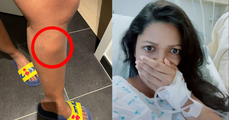 Slyšela od lékaře, že jde o drobnou vyrážku. Brzy poté jí amputovali nohu..