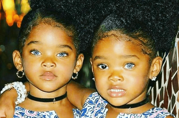 Podívejte se na „modrooká dvojčata“, která aktuálně válcují instagram!