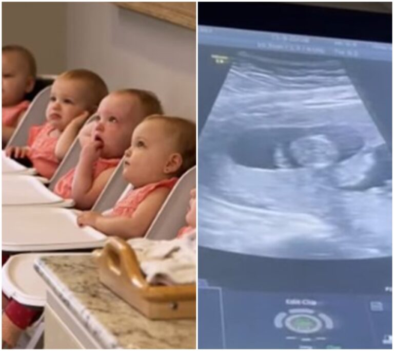 Neuvěřitelné! Pár po neúspěšných pokusech o plodnost získal pět identických čtyřčat díky této nejnovější metodě!