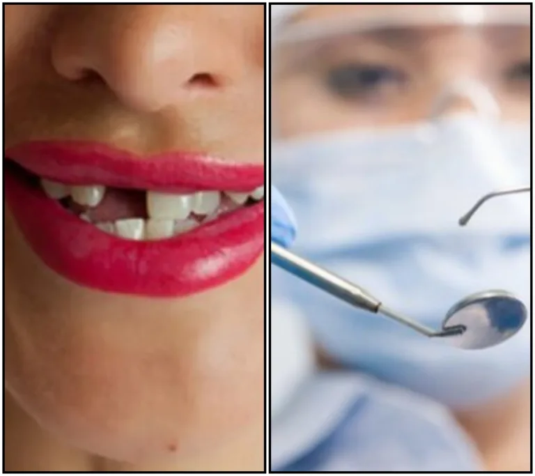 Bez zubů a naděje: Jak zubaři zanechávají tisíce lidí bez zdravotní péče!