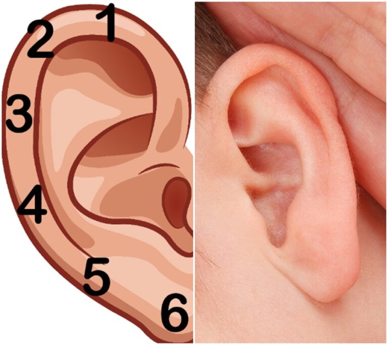 Zbavte se bolesti jednoduše pomocí ucha: Šest bodů pro úlevu od bolesti na těle.