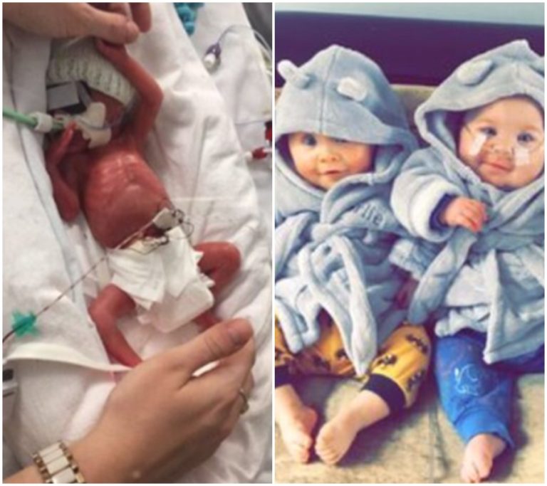 Nepředstavitelný zázrak: Tato dvojčata přežila narození ve 24. týdnu těhotenství a jejich příběh vás dojme až k slzám!