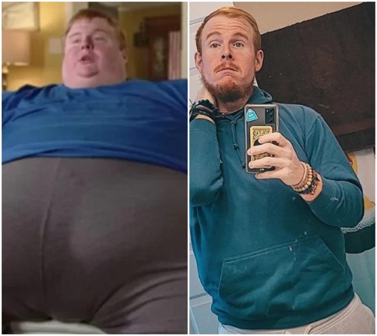 Zázrak v operaci žaludku: Muž ztratil 250 kilo a teď přímo vypouští své problémy!