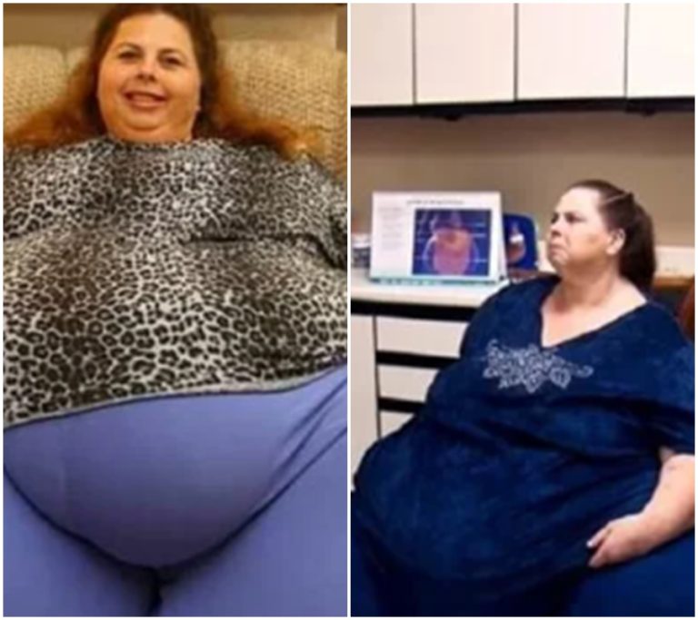 Zázračná proměna: Byla nejtlustší ženou světa, teď je neuvěřitelně transformovaná po ztrátě 250 kilo!