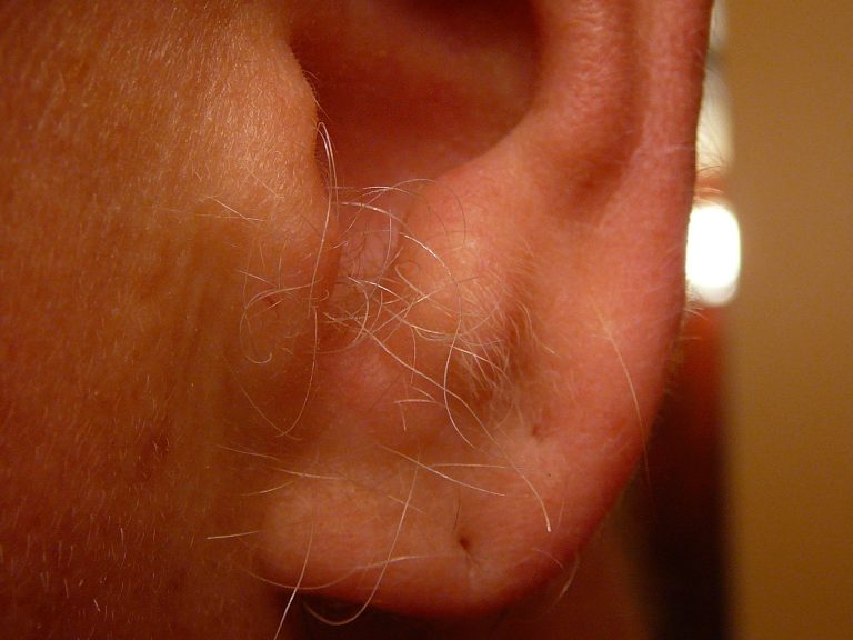 Pokud vám rostou chloupky z uší, NEPŘEHLÍŽEJTE TO: Lékaři vydali důležité upozornění, je to příznak TÉTO závažné nemoci.