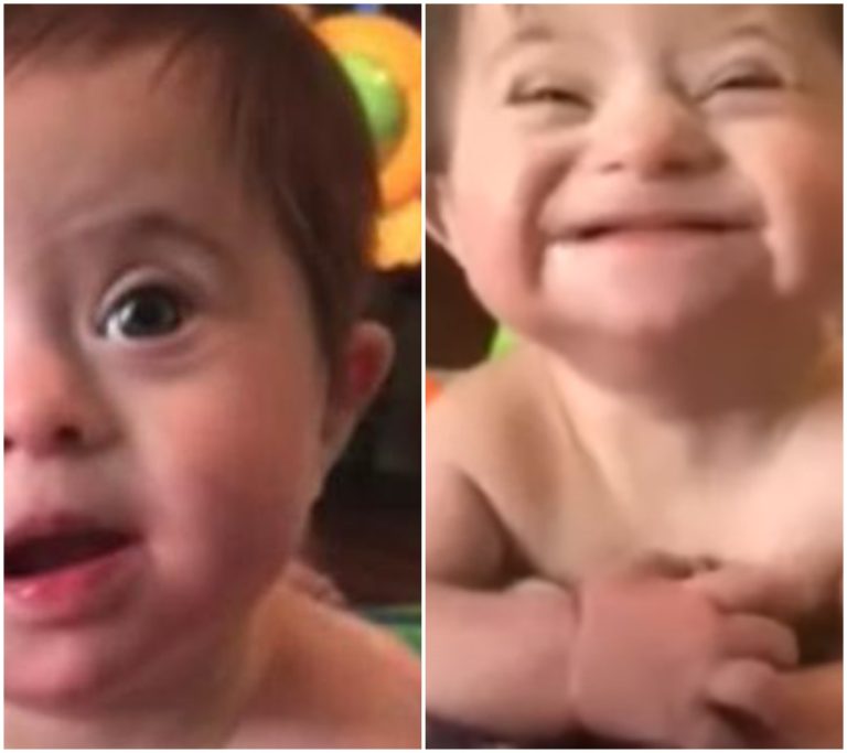 Šokující video: Adoptovaná holčička s Downovým syndromem překvapuje svět svým ‚novým úsměvem‘, maminka zachytila vše na kameře!