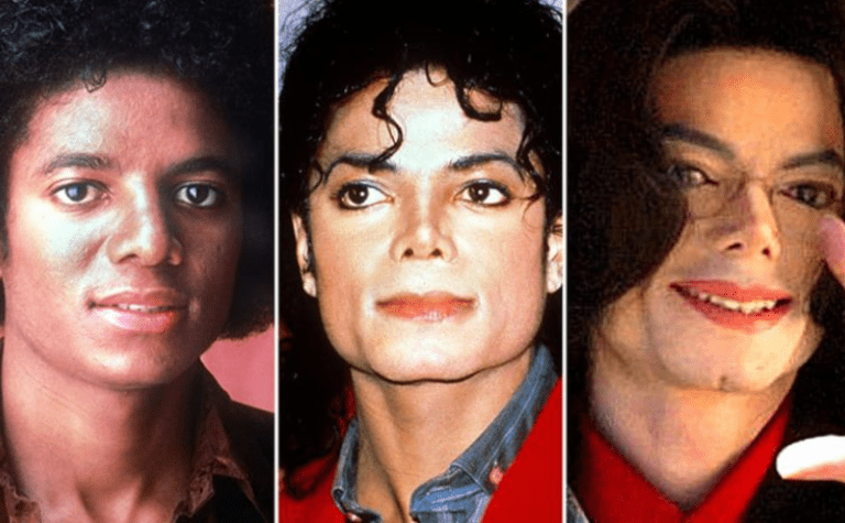 Michael Jackson: Šokující pitevní zpráva odhaluje co uchvátila na jeho těle lékaře před smrtí. Co to bylo?