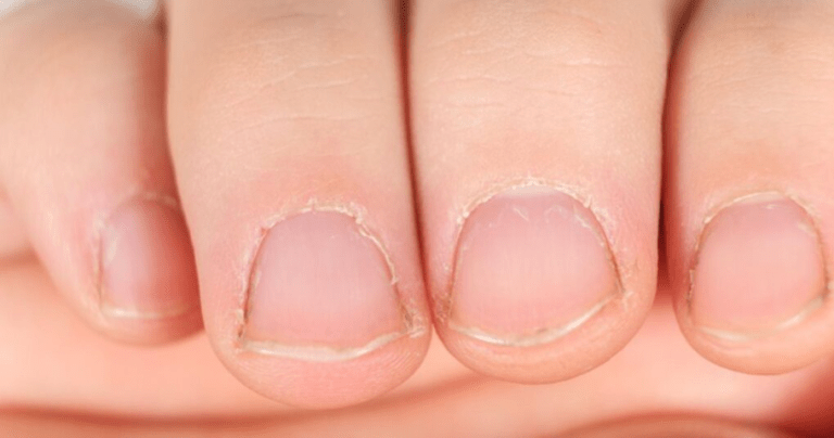 Už nemusíte trpět poškozenými nehty! Objevte sílu tohoto domácího kondicionéru, který vaše nehty promění v zdravé a silné.