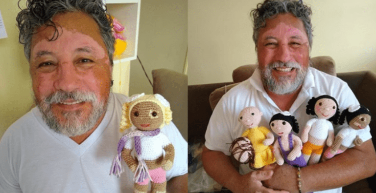 Tvoří panenky zobrazující různá postižení: Jeho cíl je podpořit děti s nemocemi, aby se cítily přijaty a normální