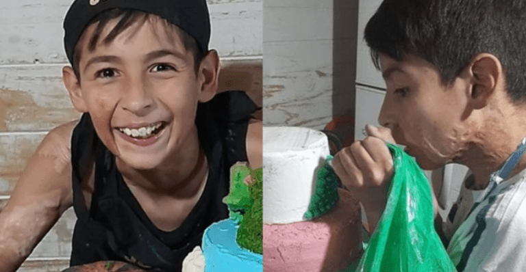 Desetiletý chlapec, postižený vážnými popáleninami, financuje své operace vlastními rukama – pečením a prodejem dortů