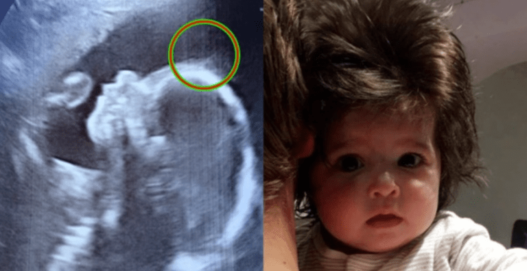 Ultrazvuk odhalil neuvěřitelné: Překvapení na hlavě mého snového dítěte! Teď její vlasová nádhera okouzluje každého, kdo se podívá.