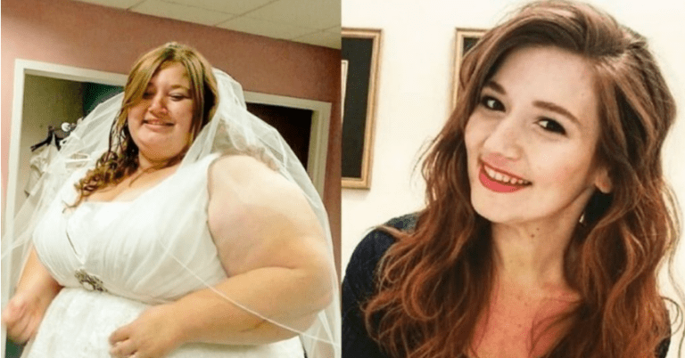 Je možné, že tato žena zhubla z 220 kg do 78kg? Nyní je hospitalizována kvůli selhání…