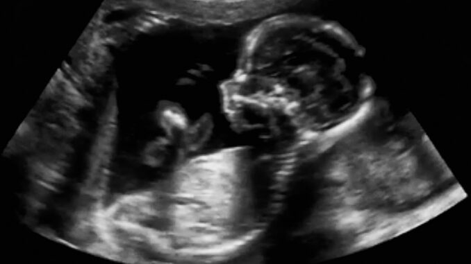 Osudový zvrat: Vzácný případ těhotenství, který budoucí rodiče zcela vykolejil!
