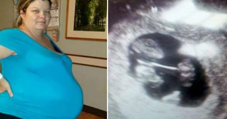 Nečekaný obrat: Matka 4 dětí překvapivě těhotná po 7 letech, ultrazvuk odhalil trojčata!