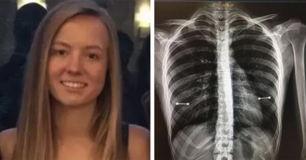Skrytá překvapení na rentgenu: dvacetiletá dívka odhaluje intimní detail, což matku naprosto šokuje!