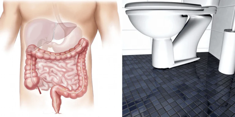 Záchodová odpověď na vaše žaludeční problémy: Skvělé tipy, jak se cítit lépe!