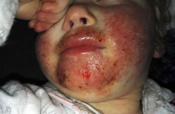 Děsivý zážitek matky: Má dcera přiběhla s krví a ranami na obličeji – Varování pro všechny rodiče!